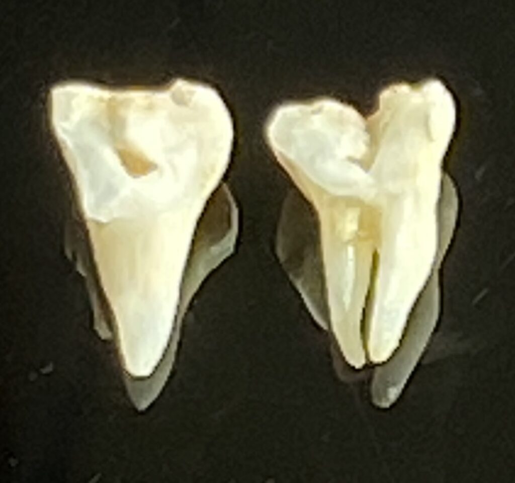 Gespaltener Zahn